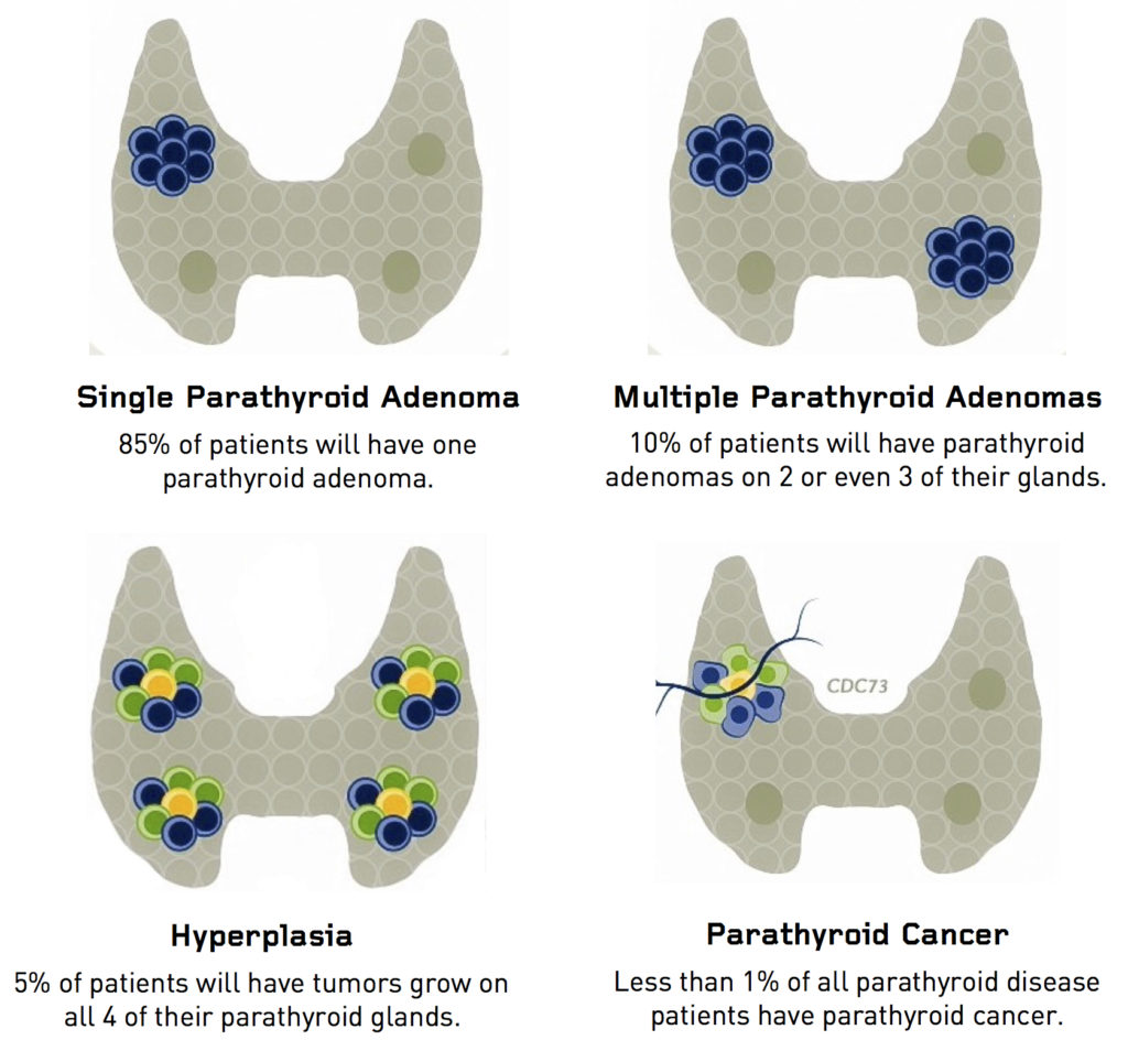 What are the signs and symptoms of parathyroid disease?