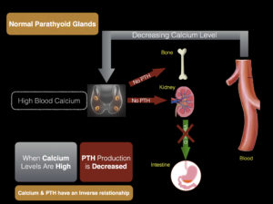 how-to-diagnose-parathyroid-disease-figure 2