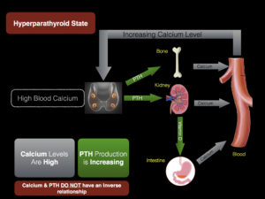 Diagram illustrating the hyperparathyroid state, showing the relationship between high blood calcium levels, increasing PTH production, and effects on bones, kidneys, and intestines, leading to increased calcium levels in the blood.