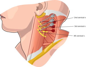 Anatomical diagram showing the location of parathyroid glands in the neck with surrounding structures.