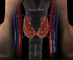 Illustration of a human neck showing the thyroid gland, voice box, trachea, carotid artery, and jugular vein.