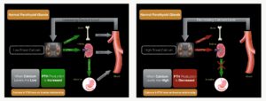 Diagrams showing the regulation of blood calcium levels by parathyroid hormone with normal parathyroid glands.