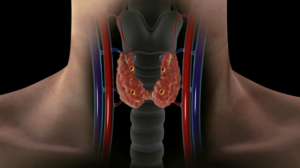 3D medical illustration of the human neck showing the thyroid gland and trachea with a dark background.