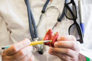 Doctor in white lab coat points on parathyroid glands in anatomic model of thyroid gland