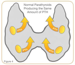 normal parathyroids producing same amount of pth