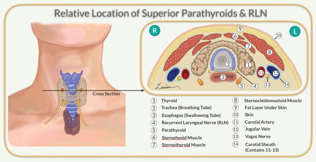 location of superior parathyroids and RLN diagram