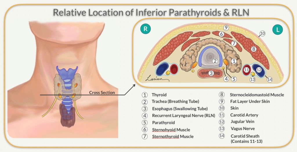 relative location of inferior parathyroids and RLN diagram