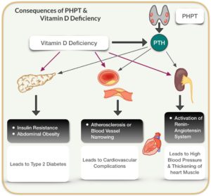 diagram of vitamin d deficiency and phpt