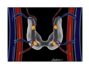 Illustration of a human thyroid and parathyroid glands with surrounding blood vessels.