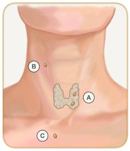Parathyroid Glands in Throat and Neck