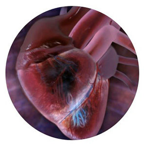 Illustration of a human heart with arteries visible.