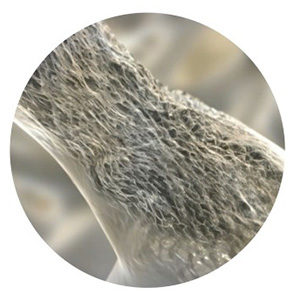 Close-up of fibrous tissue, possibly medical gauze or a bandage.