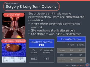 case-study-example-surgery-long-term-outcome-3