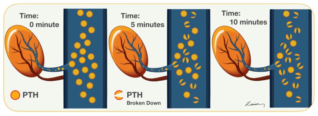 PTH breaking down