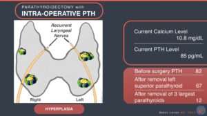 pth intra parathyroidectomy hyperplasia operative