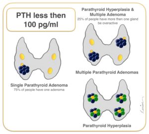 parathyroid hyperplasia and mutiple adenoma PTH less than 100 pg per ml