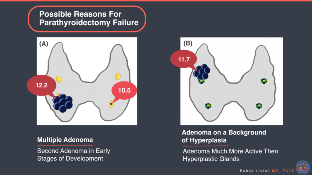 possible reasons for parathyroidectomy failure