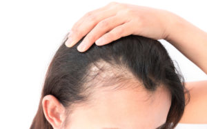 woman's head and hand pulling back her thinning hair