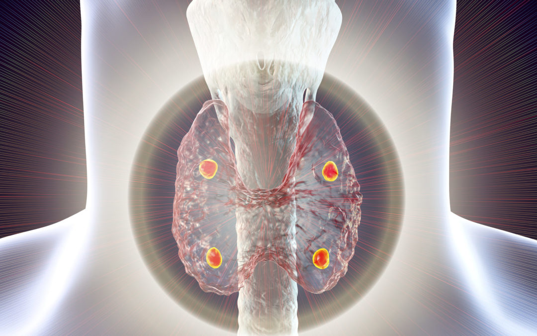 3D illustration of a human thyroid gland with highlighted nodules against a futuristic background.