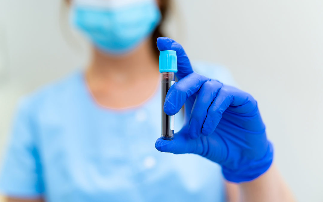 Healthcare professional in a mask holding a blood sample tube while wearing blue gloves.