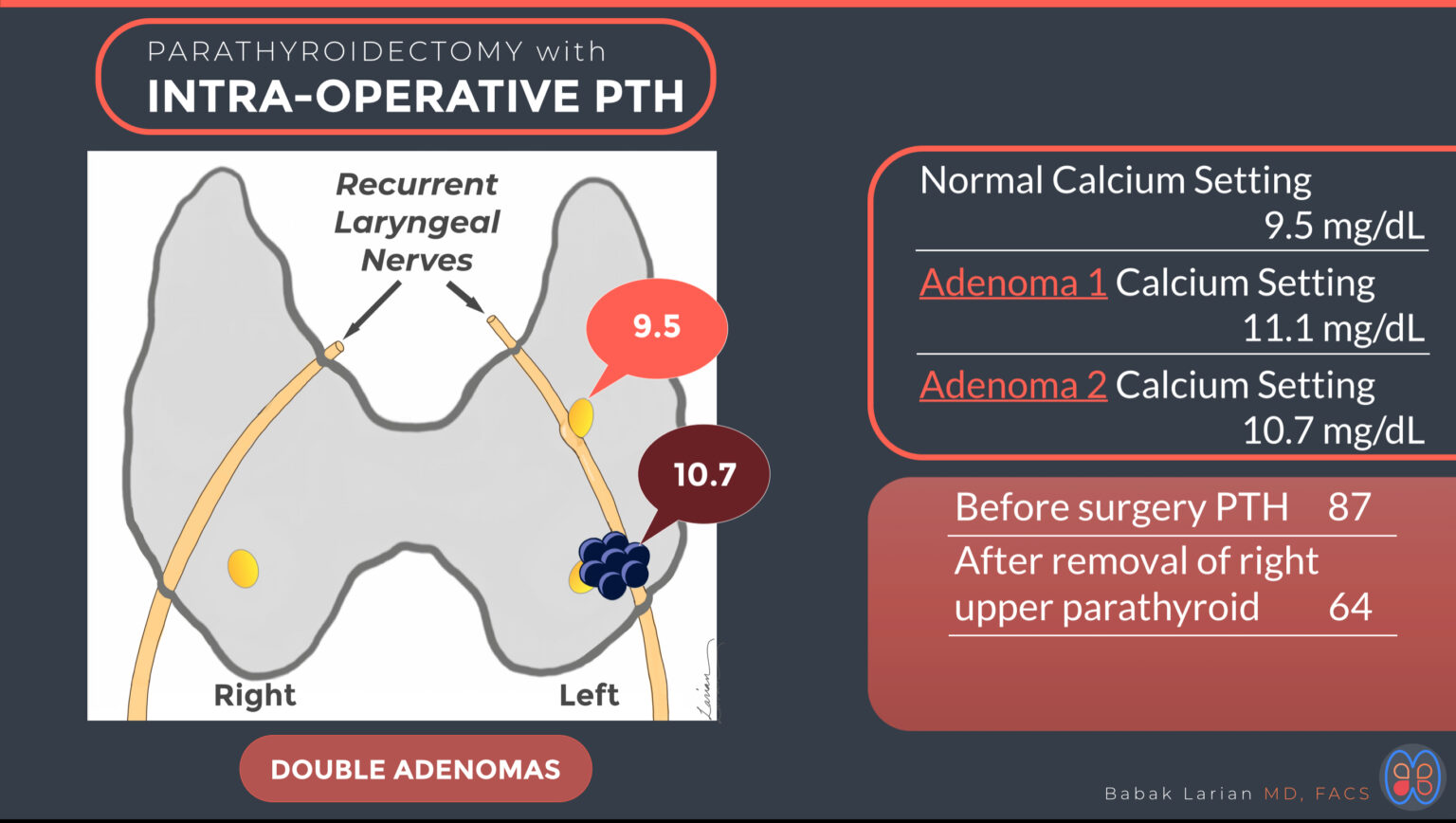 Intraoperative Parathyroid Hormone (PTH) Testing | Dr. Babak Larian