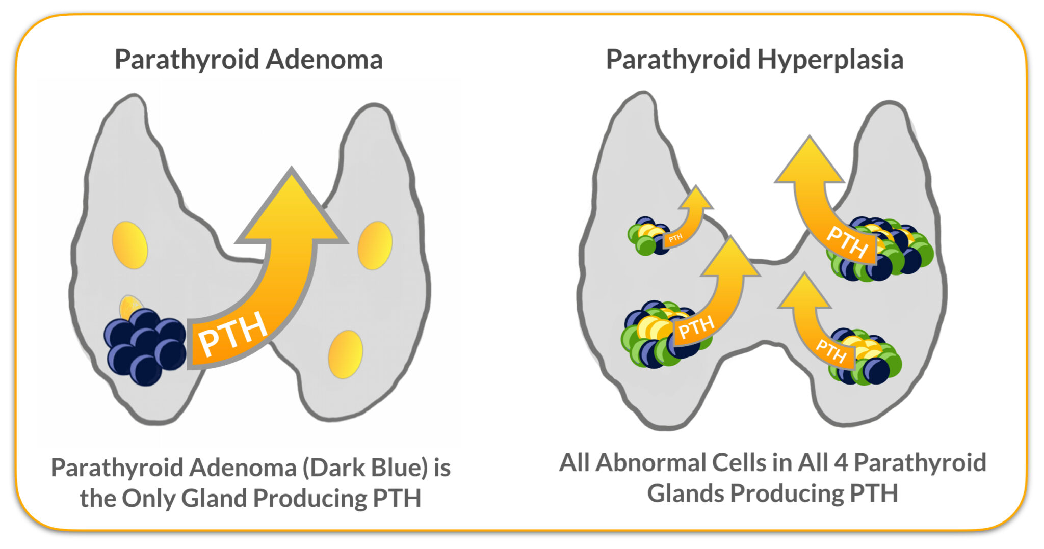 Intraoperative Parathyroid Hormone (PTH) Testing | Dr. Babak Larian