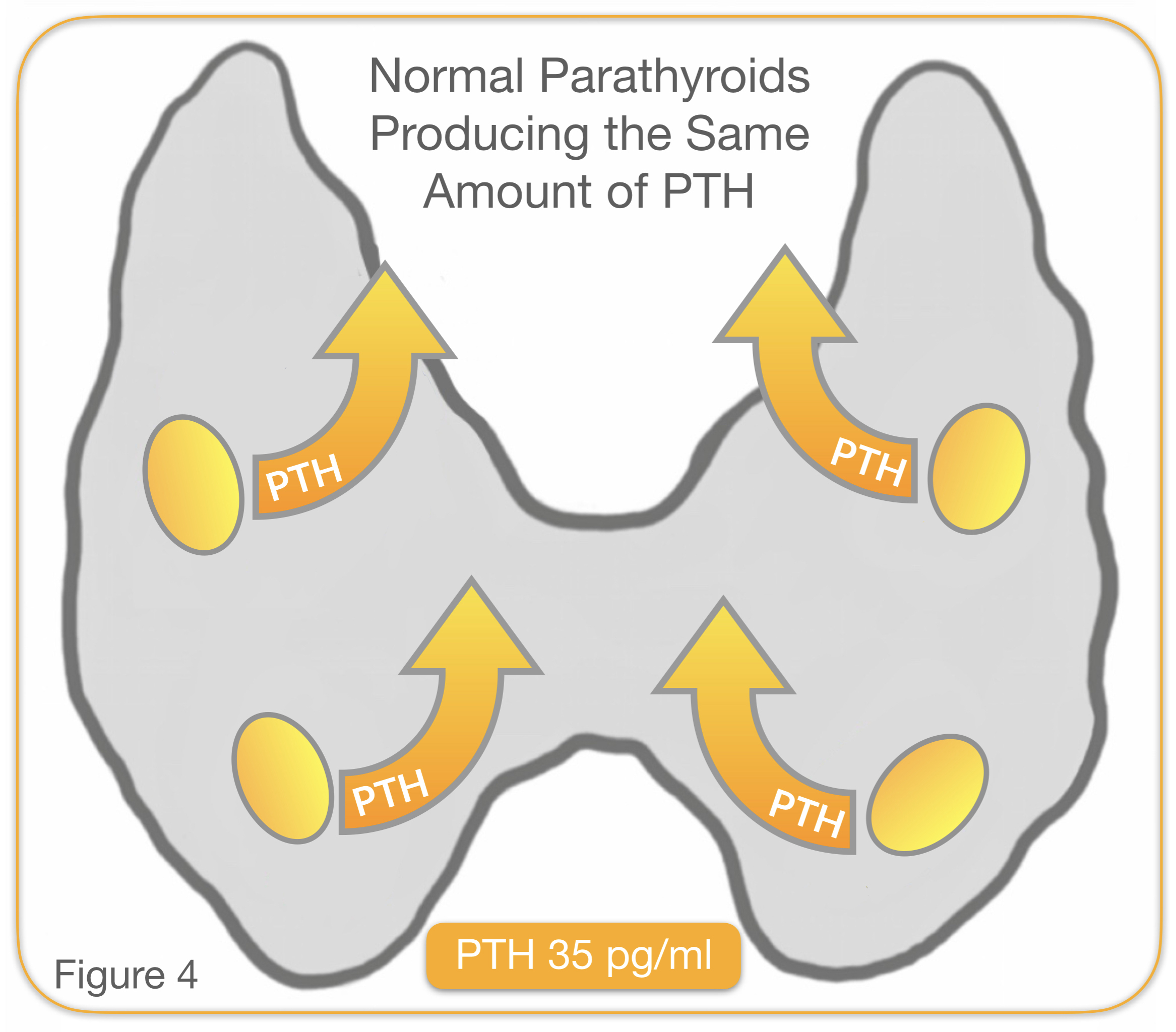 Minimally Invasive Parathyroidectomy✅