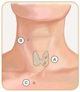 Parathyroid-Glands-in-Throat-and-Neck-260x300