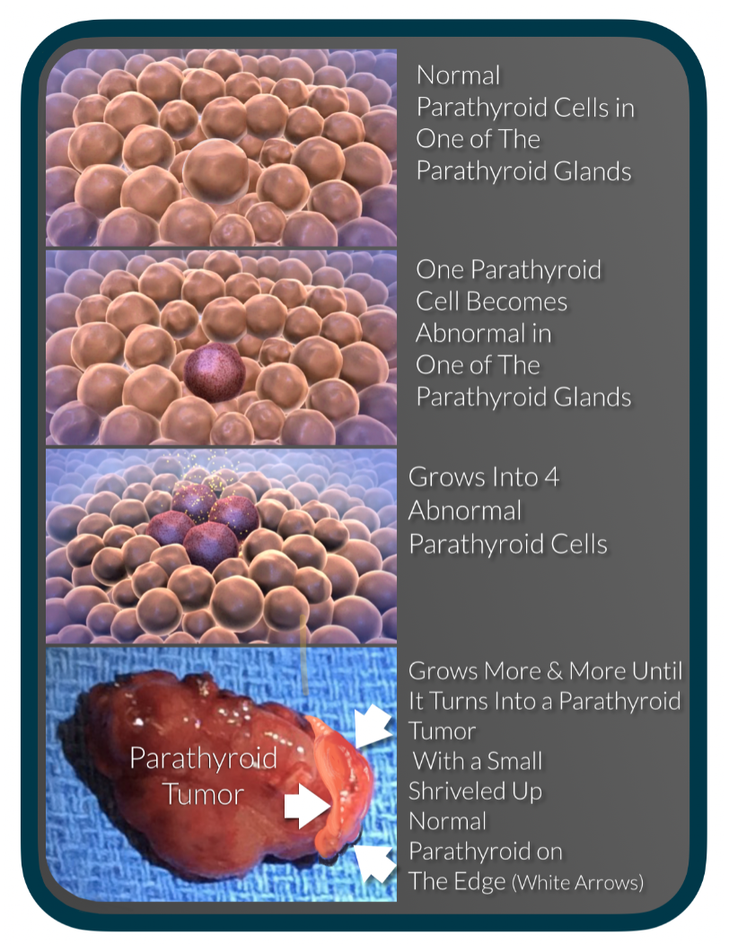 parathyroid-cells